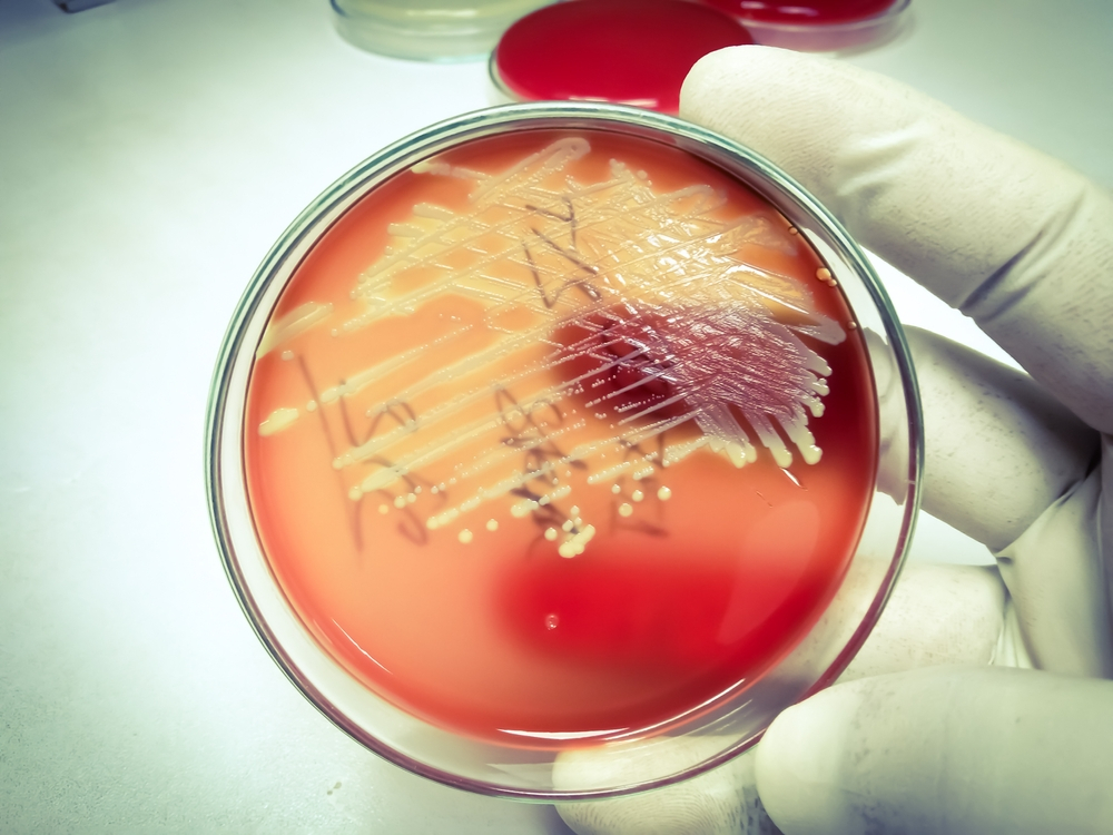 Cercetătorii descoperă bacteriile care ne pot ajuta să oprim poluarea cu plastic
