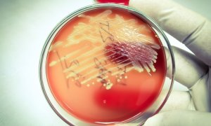Cercetătorii descoperă bacteriile care ne pot ajuta să oprim poluarea cu plastic