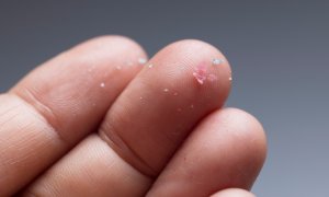 Nivelul de microplastic din creierul uman ar putea fi în creștere